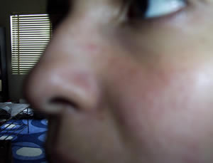 my nose, sans hole